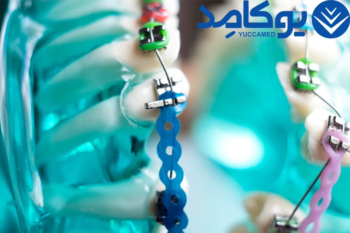 جراحی تنگی کانال نخاعی