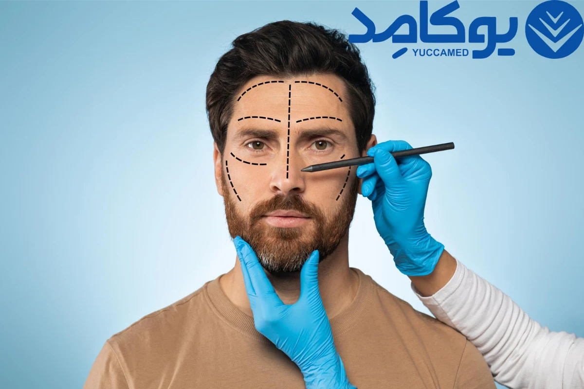 بلفاروپلاستی (جراحی پلک)