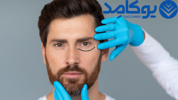 بلفاروپلاستی (جراحی پلک)