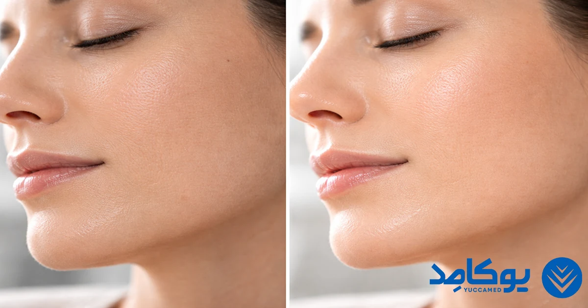 بهترین دستگاه آبرسان پوست برای خشکی و چروک